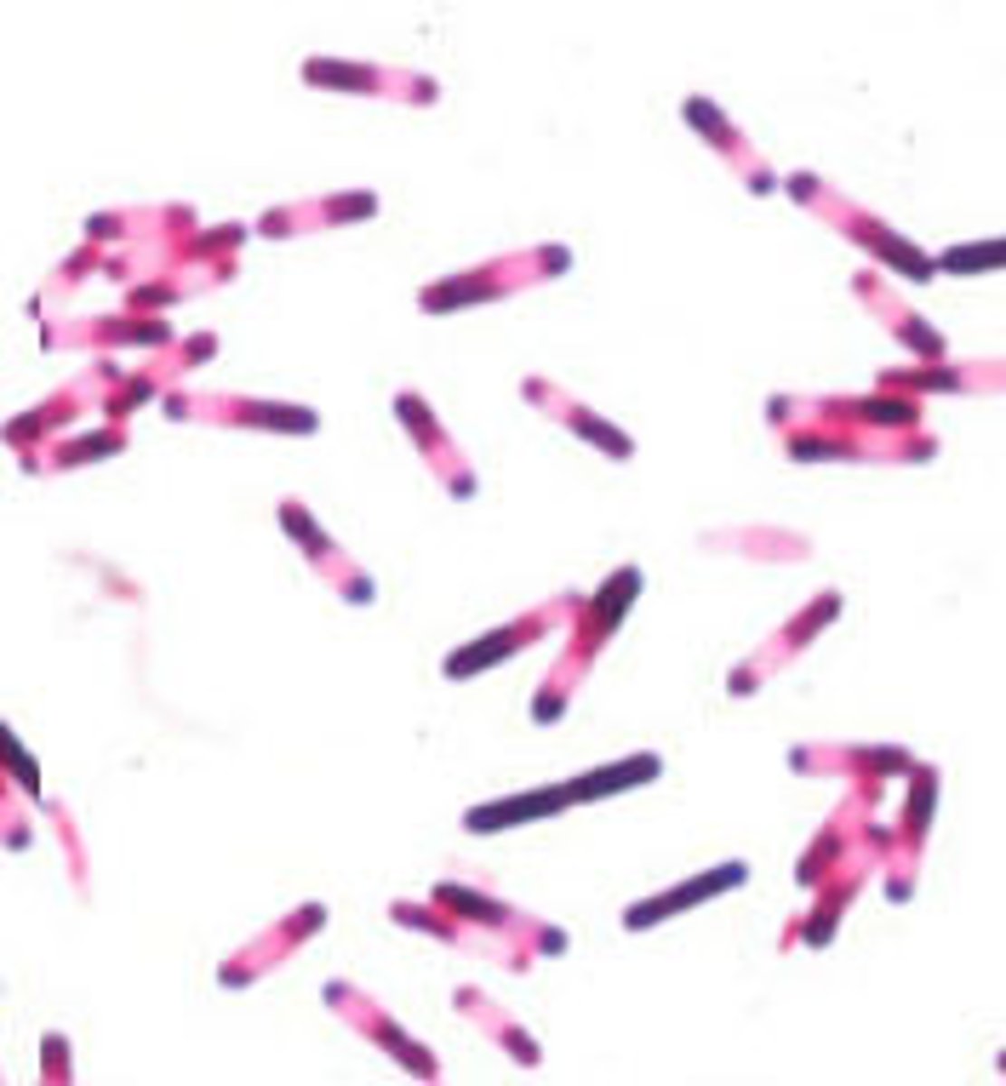 <p>Predict what are the clear circles found in this Gram stain.</p>