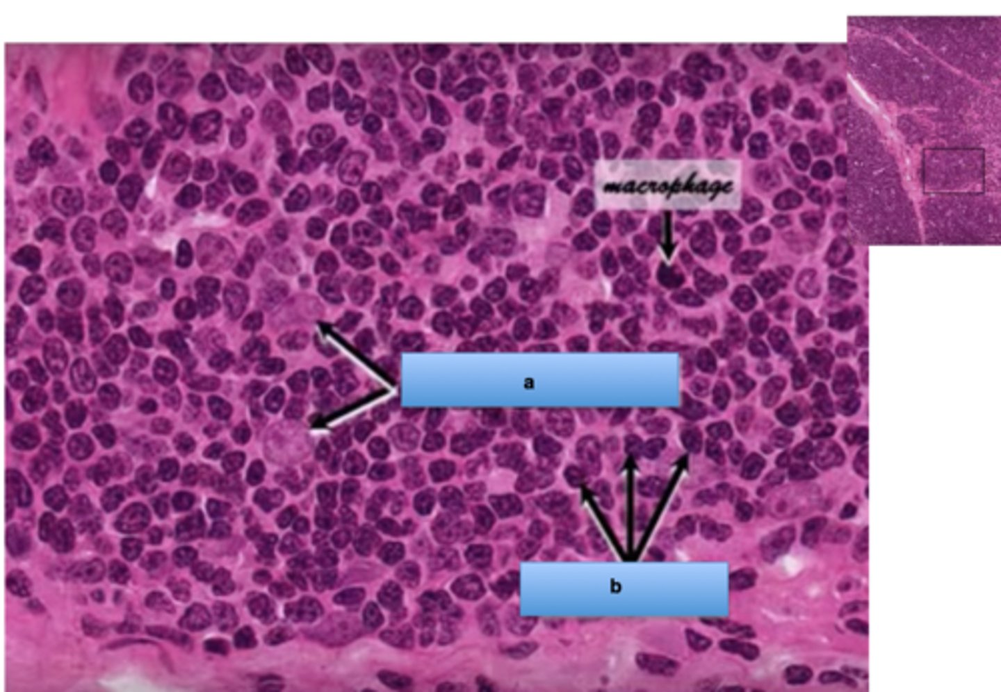 <p>what is this (darker spots)</p>
