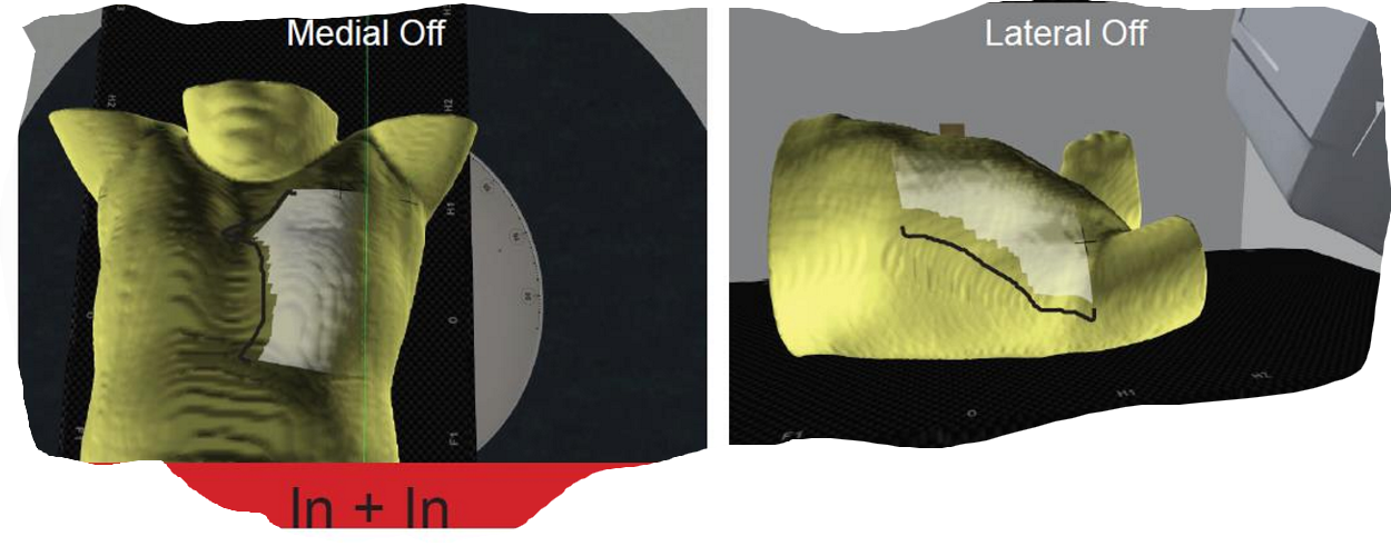 <p>if our field light is ‘in + in”, what two things is that telling us about our isocenter?</p>