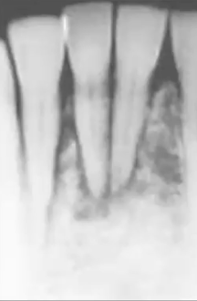 <p>What is this PA showing?</p>