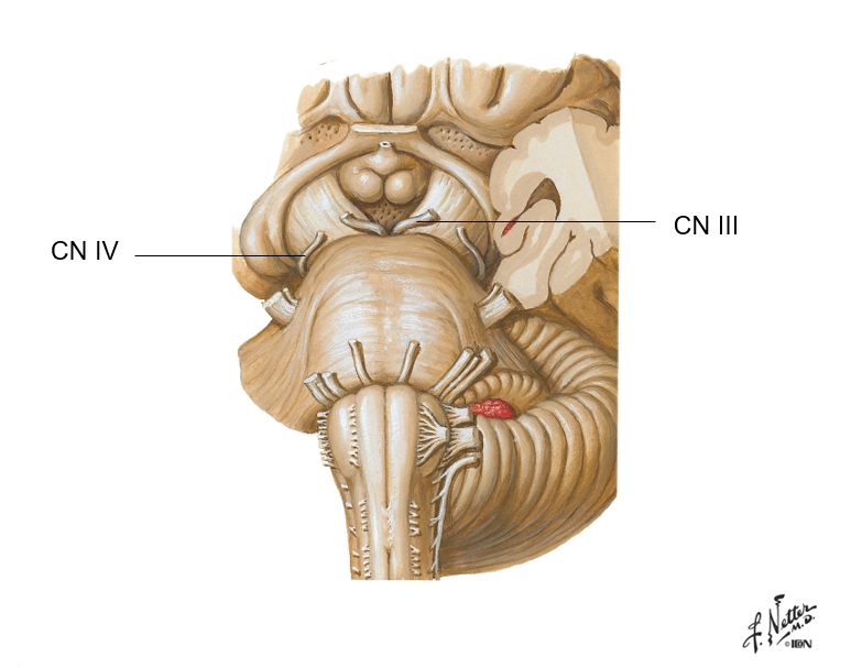 <p>Cranial Nerves III &amp; IV (Oculomotor and Trochlear) </p>