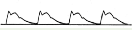 <p>Pressure of the pulse: increased</p><p>Contour: double systolic peak</p><p>Causes: aortic regurgitation, aortic stenosis, hypertrophic cardiomyopathy</p><p></p>