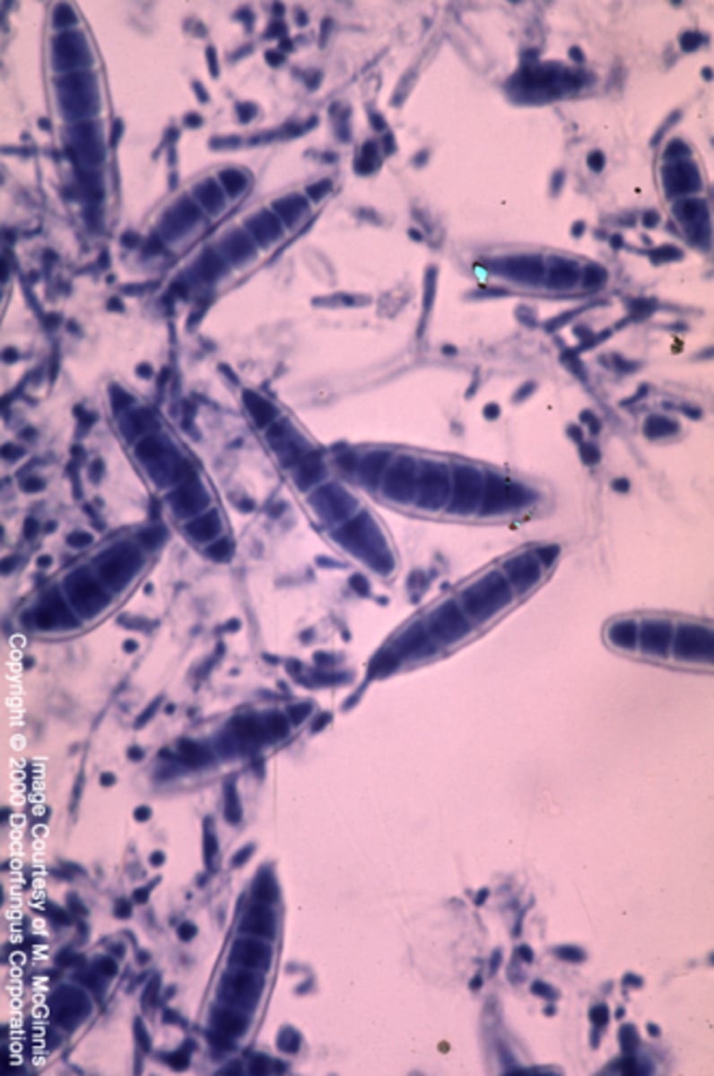 <p>Colony: powdery, granular, yellow-beige</p><p>Reverse: same or red-brown</p><p>Microconidia: claviform (club-shaped)</p><p>Macroconidia: fusiform spindle, septate, thin-moderate cell wall, &lt; 6 cells in spindle, spindle ends rounded</p><p>septate hyphae</p><p>Conditions: scalp and skin</p><p>animal cases more common</p>