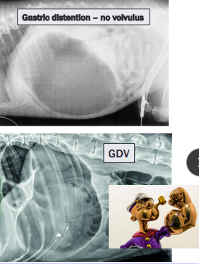 <ul><li><p><span style="background-color: transparent;"><strong><span>Et: </span></strong><span>Rapid distention of stomach with air + volvulus @ axis</span></span></p><ul><li><p><span style="background-color: transparent;"><span>Compression of caudal vena cava → ↓ venous return → </span><u><span>hypovolemic shock</span></u></span></p></li><li><p><span style="background-color: transparent;"><u><span>EMERGENCY</span></u></span></p></li></ul></li><li><p><span style="background-color: transparent;"><strong><span>Sig: </span></strong><span>Old,</span><u><span> Lg, deep chest</span></u><span>, rapid eating, aerophagia, raised food bowls, anxiety</span></span></p></li><li><p><span style="background-color: transparent;"><strong><span>Cs: </span></strong></span><span style="background-color: transparent; color: green;"><strong><u><span>non-productive retching, salivation, distention</span></u></strong></span><span style="background-color: transparent;"><strong><u><span>, tympany, </span></u></strong></span><span style="background-color: transparent; color: green;"><strong><u><span>tachycardia</span></u></strong></span><span style="background-color: transparent;"><strong><u><span>, weak pulse, shock</span></u></strong></span></p></li><li><p><span style="background-color: transparent;"><strong><span>Dt: </span></strong></span><span style="background-color: transparent; color: green;"><strong><u><span>R-Lateral abdominal rads</span></u></strong><span>,</span></span><span style="background-color: transparent;"><span> </span><u><span>double bubble, ↑ PCV</span></u><span>, </span></span><span style="background-color: transparent; color: green;"><strong><u><span>metabolic acidosis</span></u></strong></span><span style="background-color: transparent;"><span>, coagulation defects</span></span></p></li><li><p><span style="background-color: transparent;"><strong><span>Tx: </span></strong></span></p><ul><li><p><span style="background-color: transparent;"><strong><span>Initial: </span></strong><span>LRS shock fluids, O2, Gastric decompression (NG tube or trocarization), Antibiotics</span></span></p></li><li><p><span style="background-color: transparent;"><strong><span>Sx: </span></strong></span><span style="background-color: transparent; color: green;"><span>Emerg Gastropexy</span></span></p></li><li><p><span style="background-color: transparent;"><strong><span>Prevent: Prophylactic gastropexy</span></strong><span>, </span><strong><span>slow feeding</span></strong><span>, sm meals</span></span></p></li></ul></li></ul><img src="https://knowt-user-attachments.s3.amazonaws.com/f950b921-a02c-4242-a89d-1bfa4af2704b.png" data-width="50%" data-align="center" alt="VPC"><p></p>