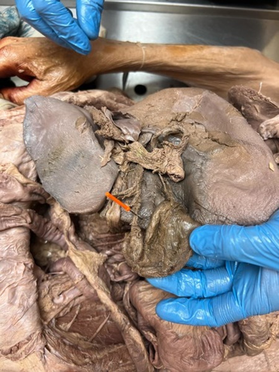 <p>cystic artery</p>