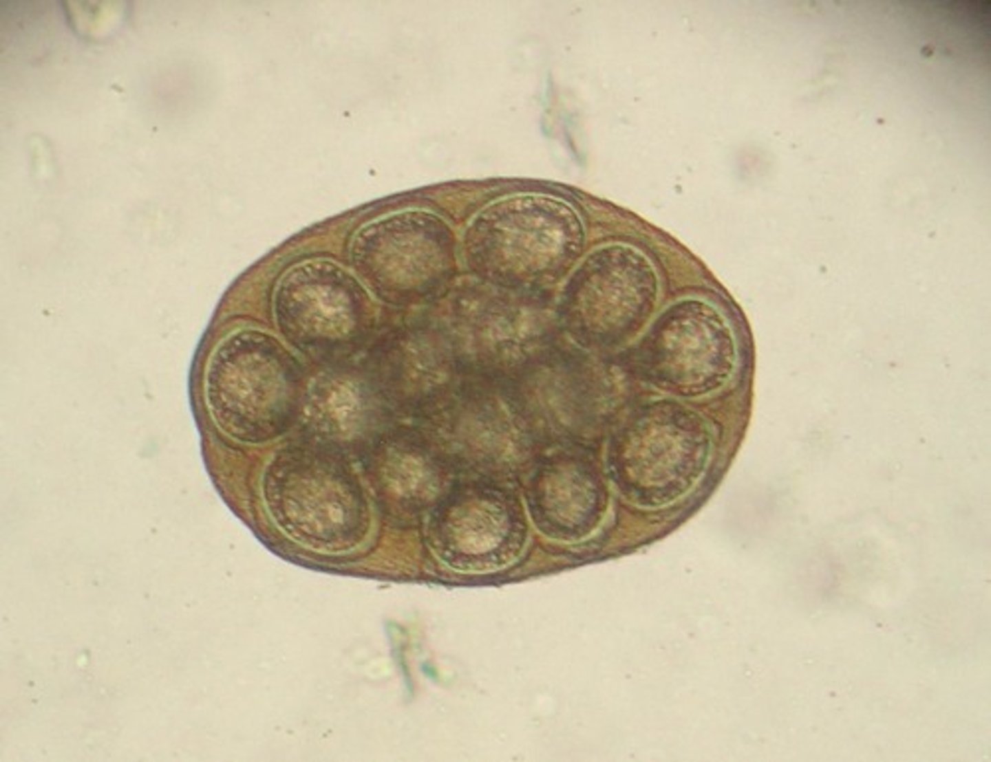 <p>dipylidium, echinococcus, taenia</p><p>see proglottids!</p><p>from ingesting the flea</p><p>zoonotic - hydatid cyst disease</p>