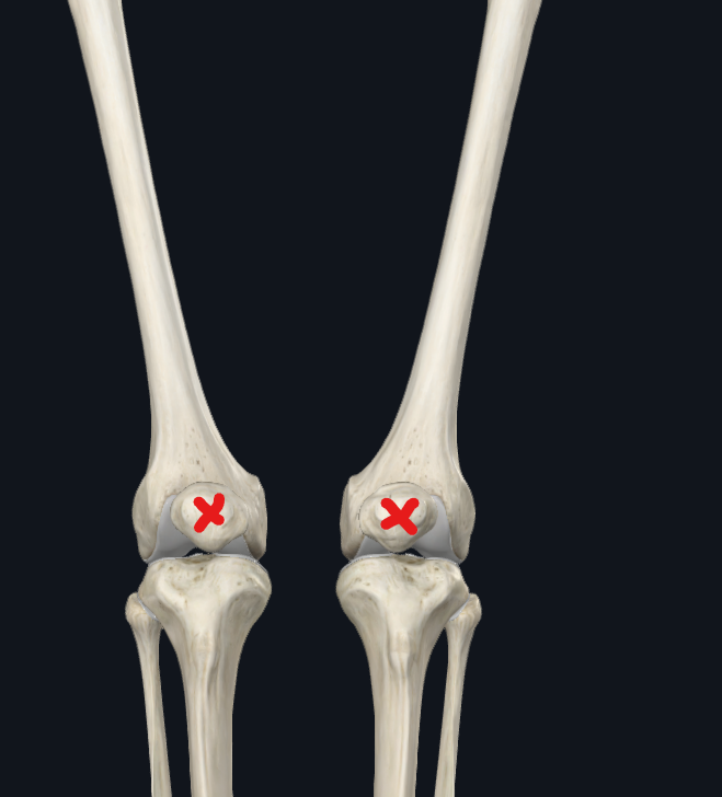 <p>What bone is this</p>