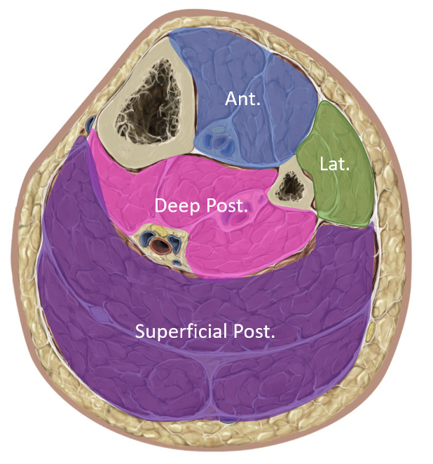 * fibrous sheaths surrounding compartments __**don’t stretch**__
* if damage + swelling occur, pressure can build up
* common sites: Shank & Forearm