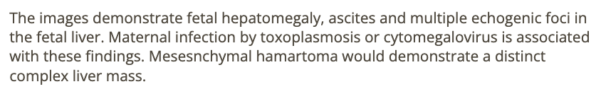 <p>b) toxoplasmosis infection</p>