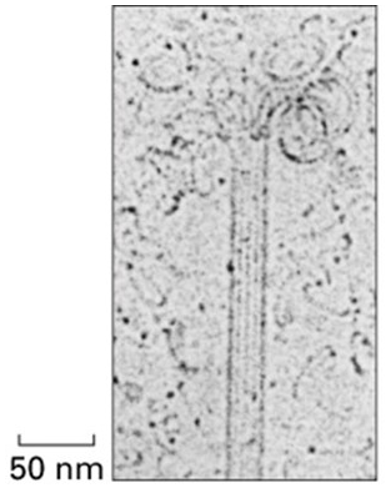 What is shown in the electron microscope image above?