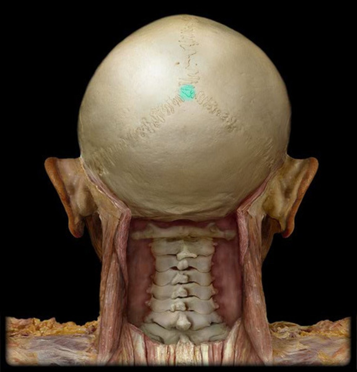<p>intersection of lamboid and sagittal sutures</p>