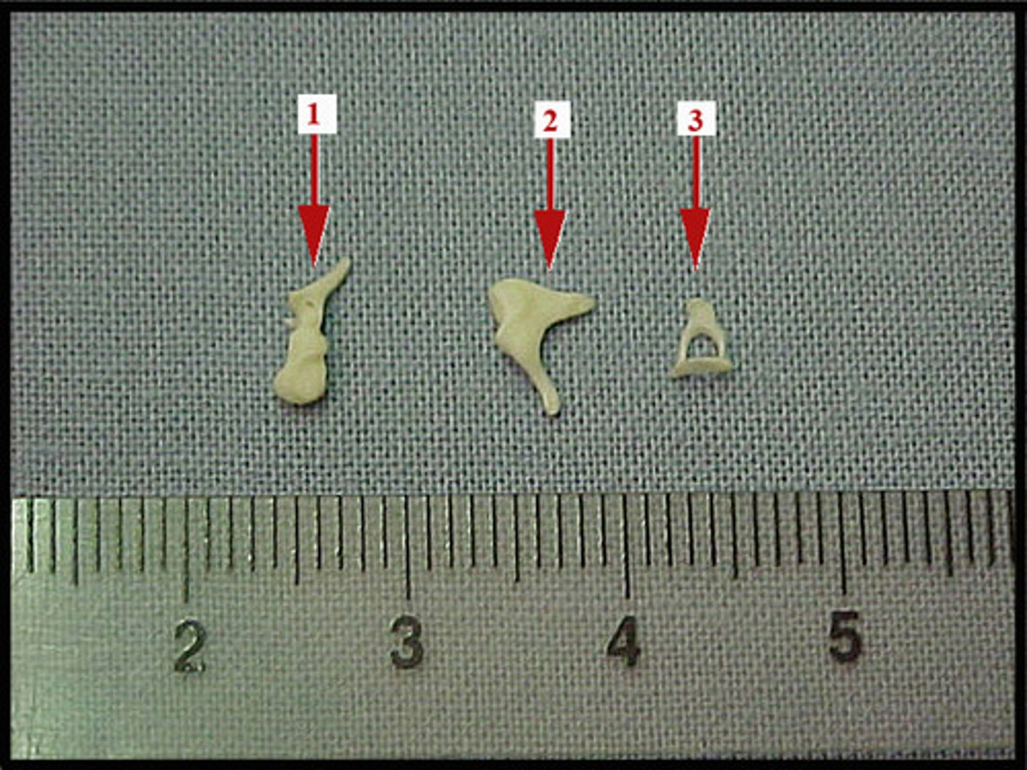 <p>auditory ossicles</p>