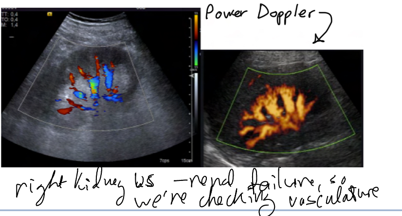 <p>Checks vasculature, only to see movement, not direction</p>
