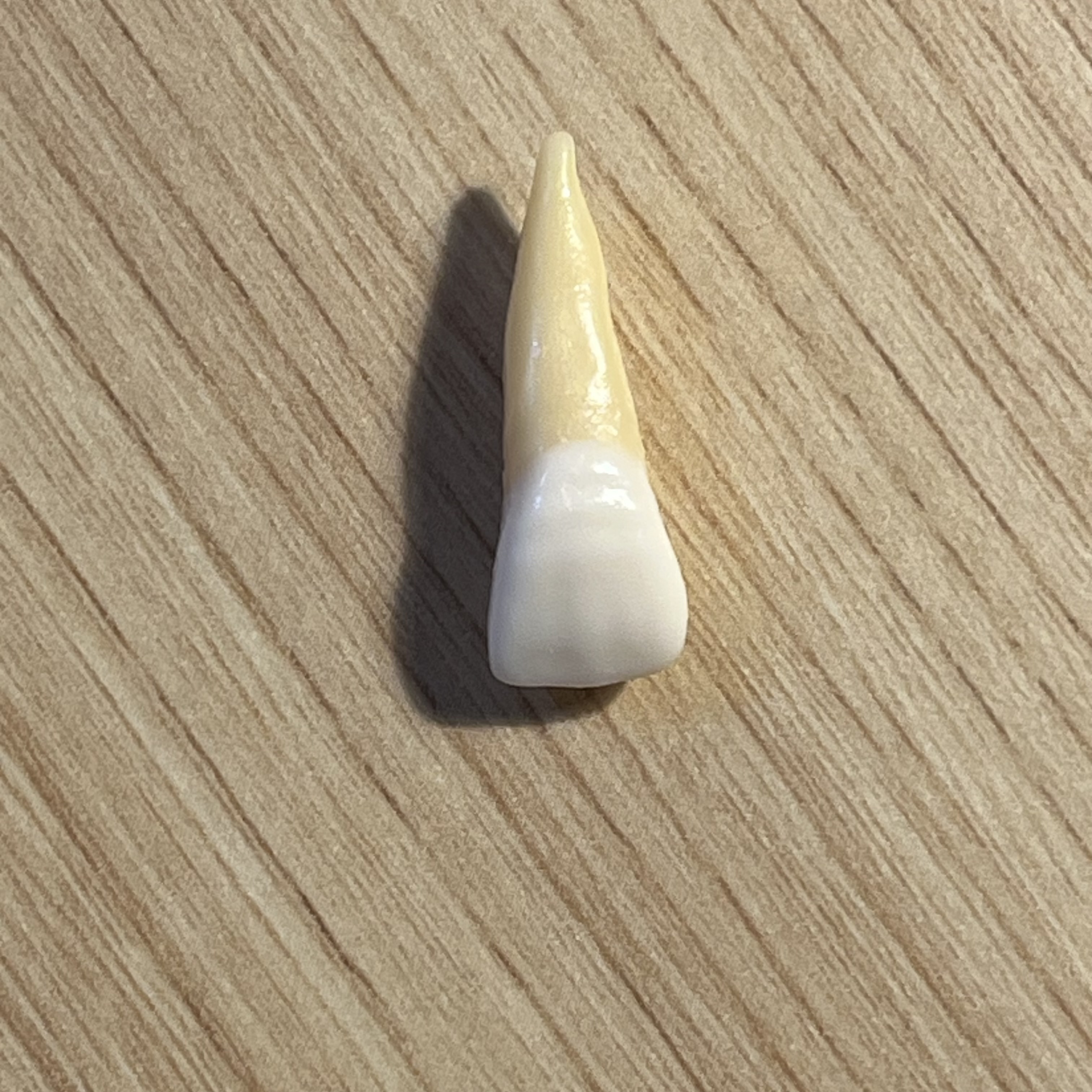 <p>What tooth is this (with view)?</p>