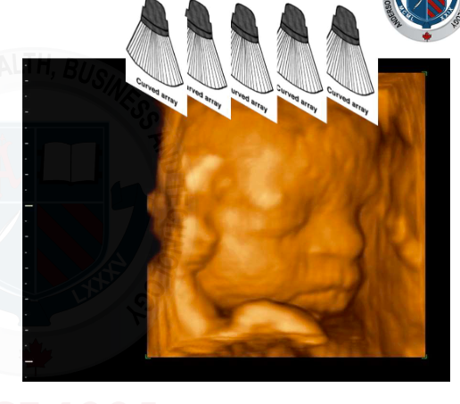 <p>Type of imaging</p>