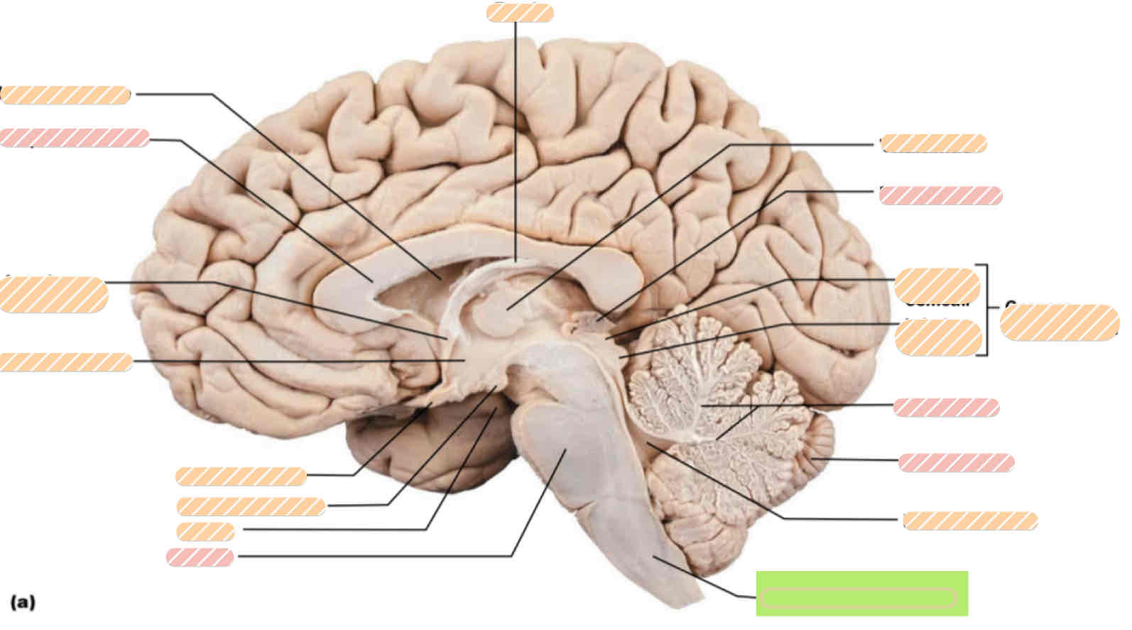 <p>Human brain</p>