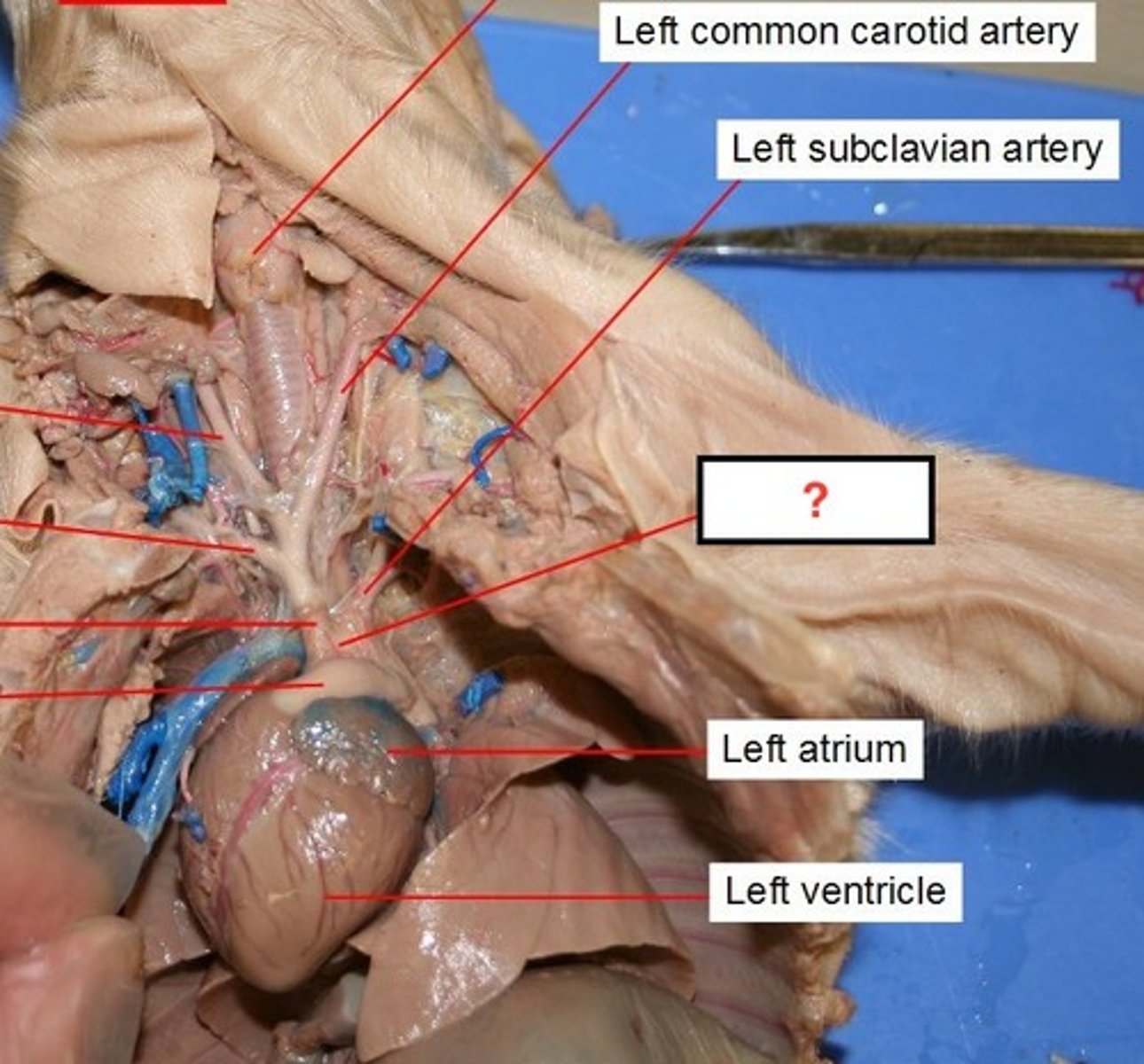 <p>large arterial trunk that carries blood from the heart to be distributed by branch arteries through the body.</p>