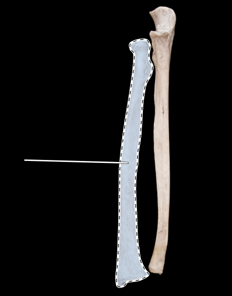 <p>Name this bone.</p><p>(Anterior view).</p>
