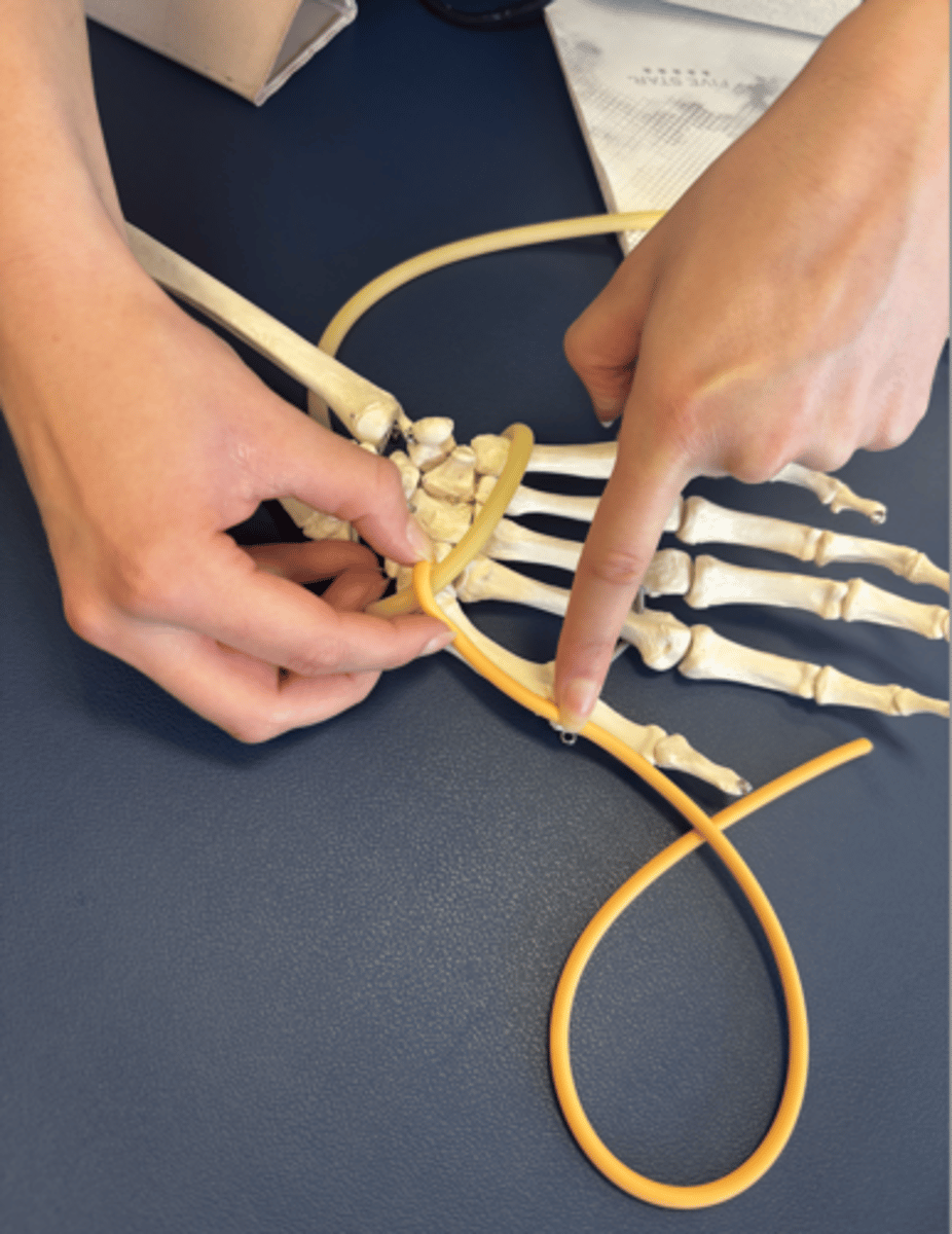 <p>What is this muscle?</p>