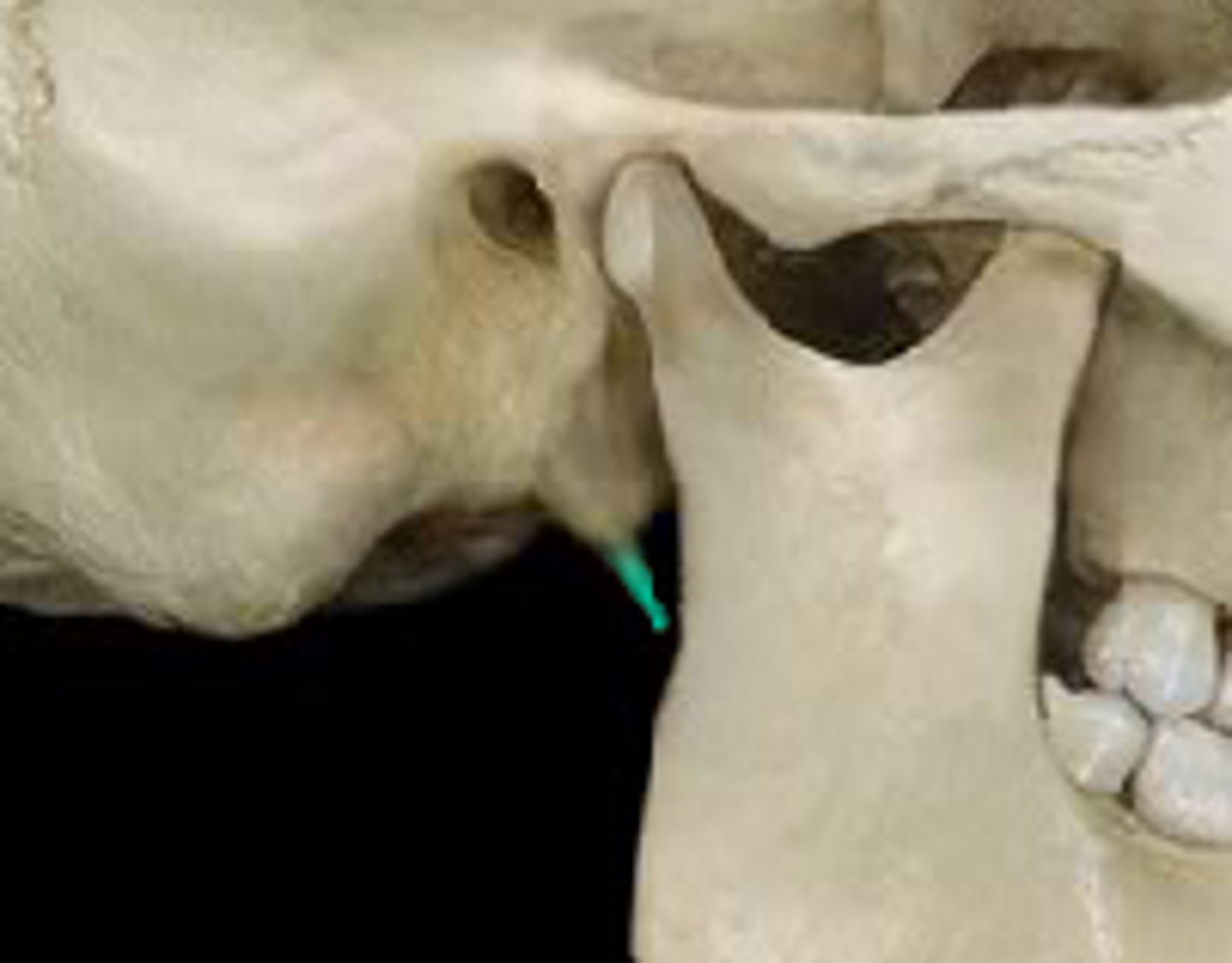 <p>What bone is this?</p>