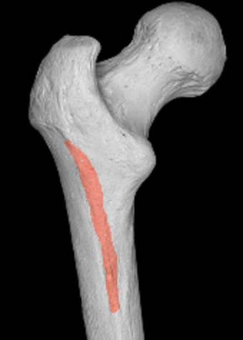 <p>bumpy triangle below greater trochanter of femur</p>