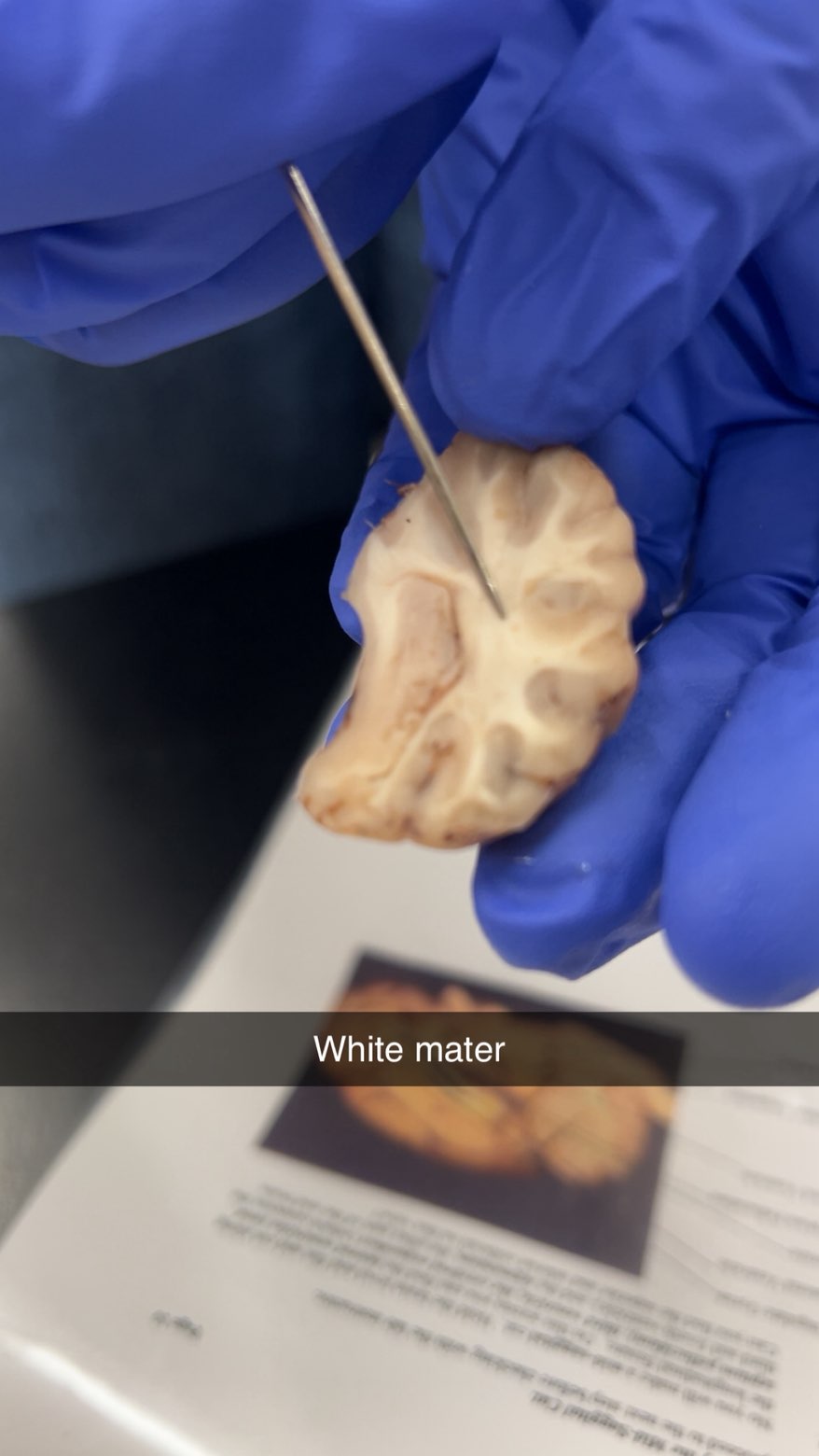 <p>white matter</p>