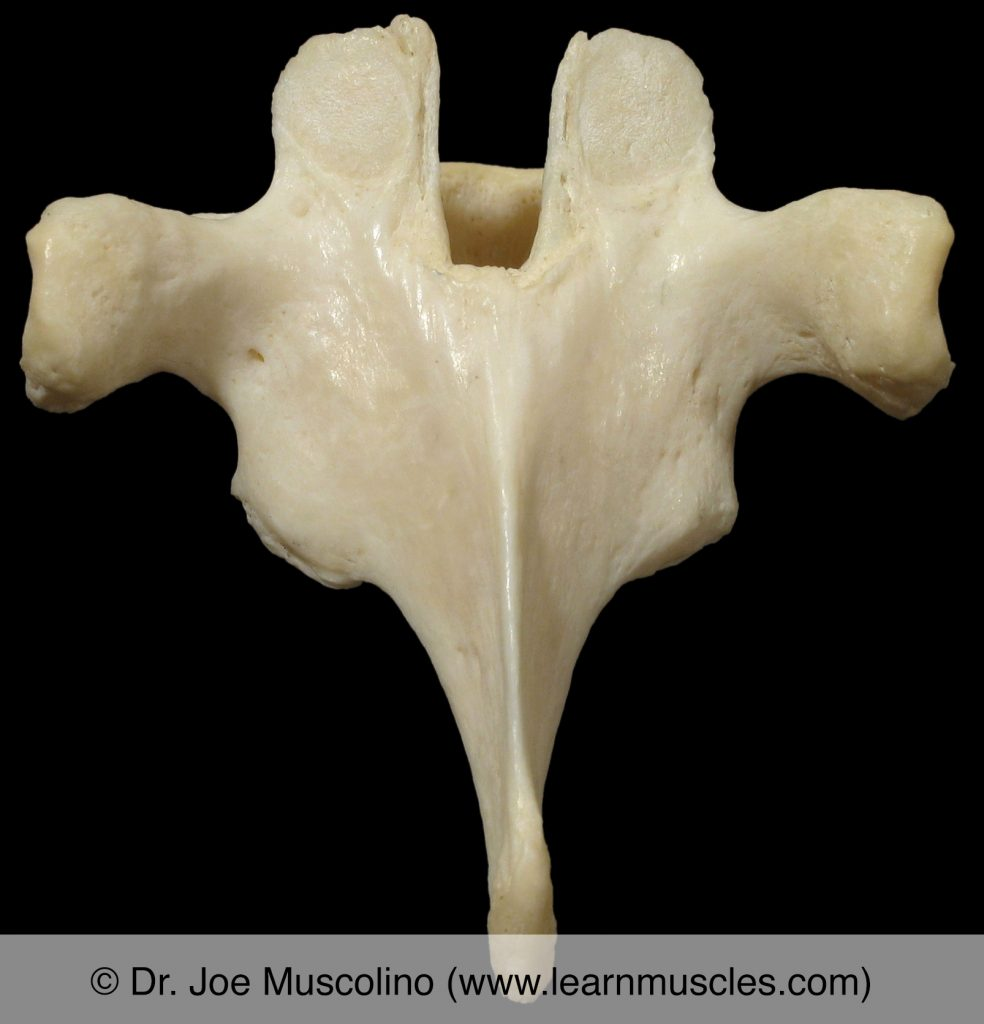 <p>Identify what TYPE of vertebrae this is</p>