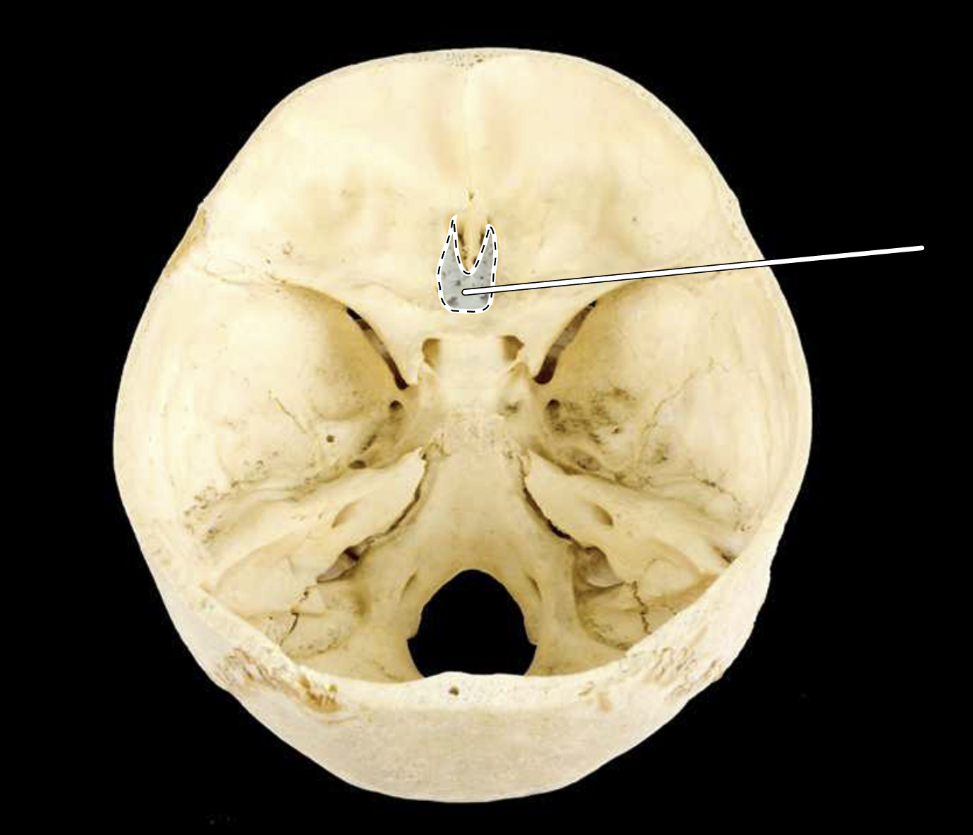 <p>Name the highlighted portion.</p><p>(Posterosuperior view of cranial cavity).</p>