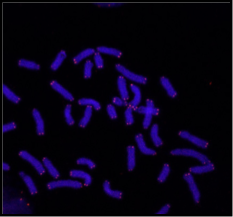 <p>what are telomeres </p>