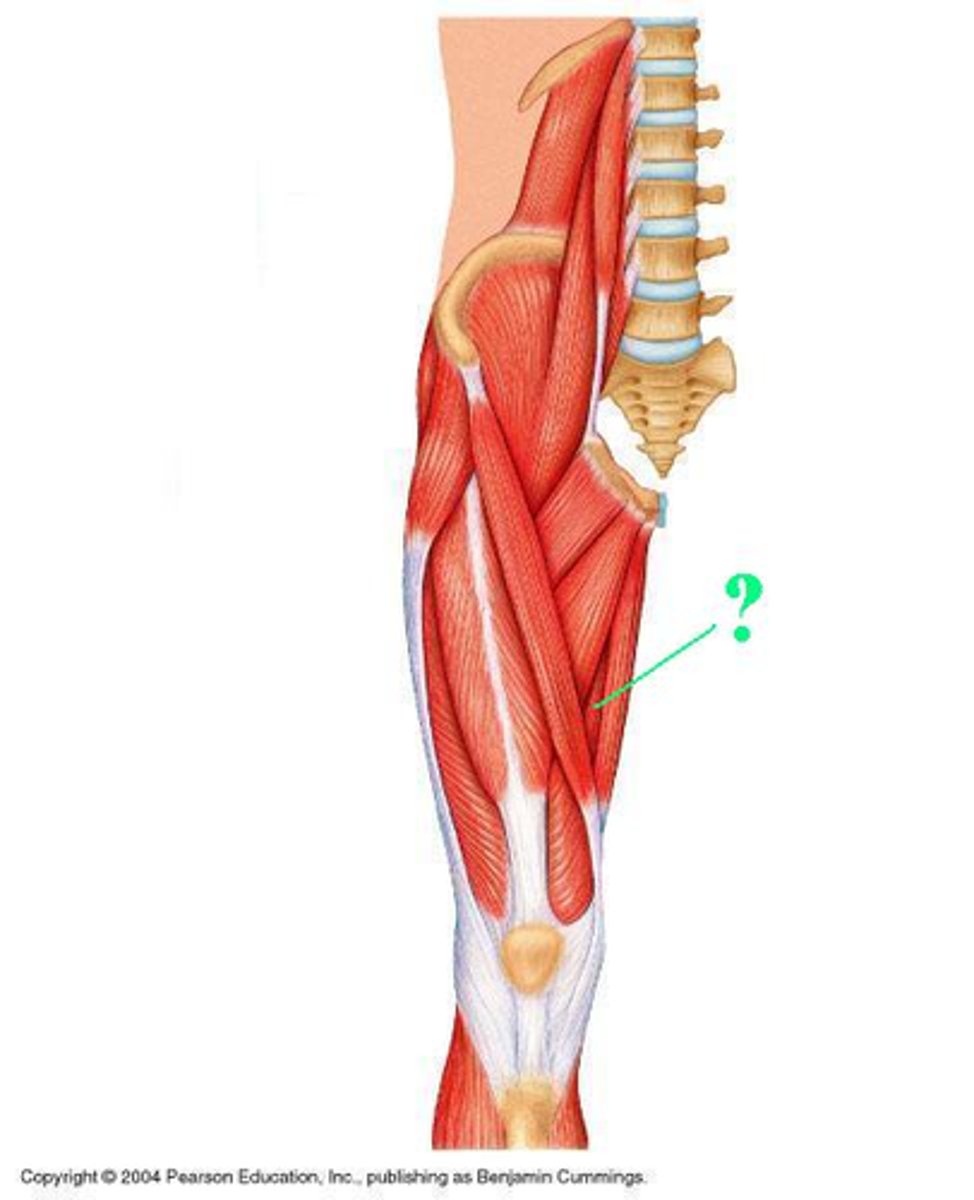 <p>Identify the indicated muscle</p>