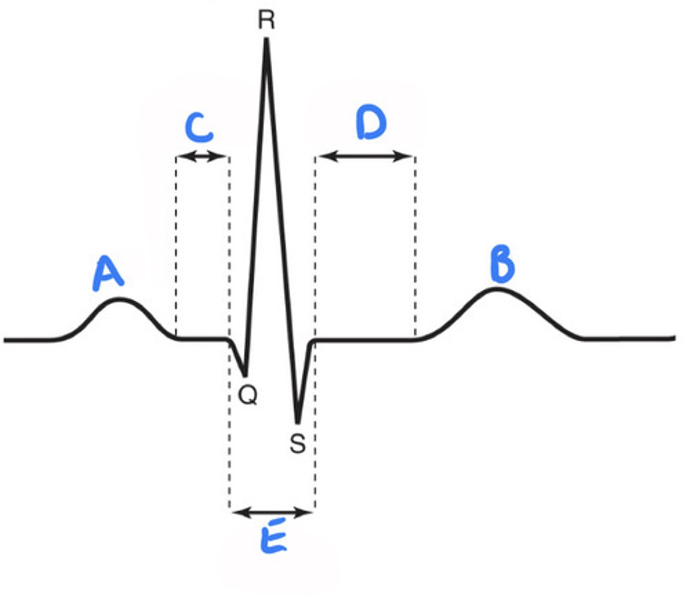 <p>Associated with atrial cells' plateau (atria are contracting</p>