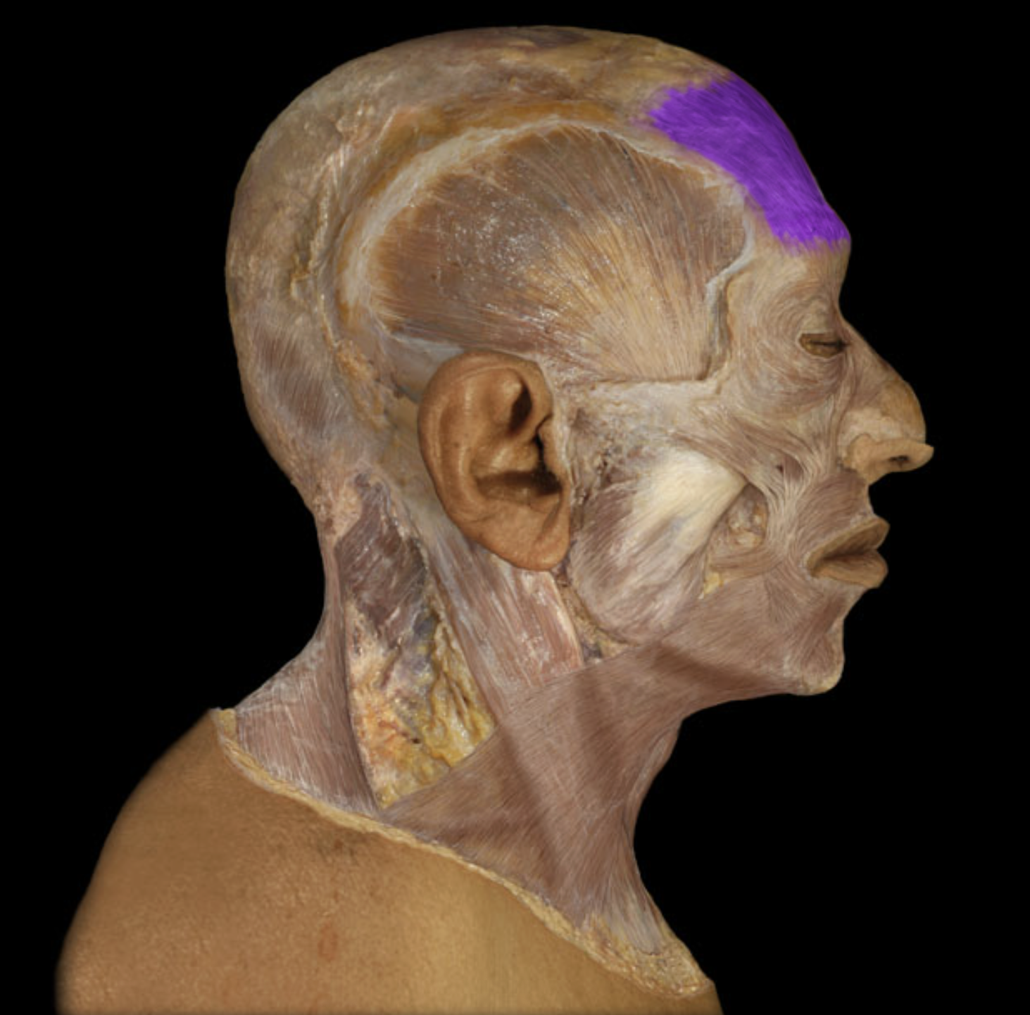 <p>What muscle is this?</p>
