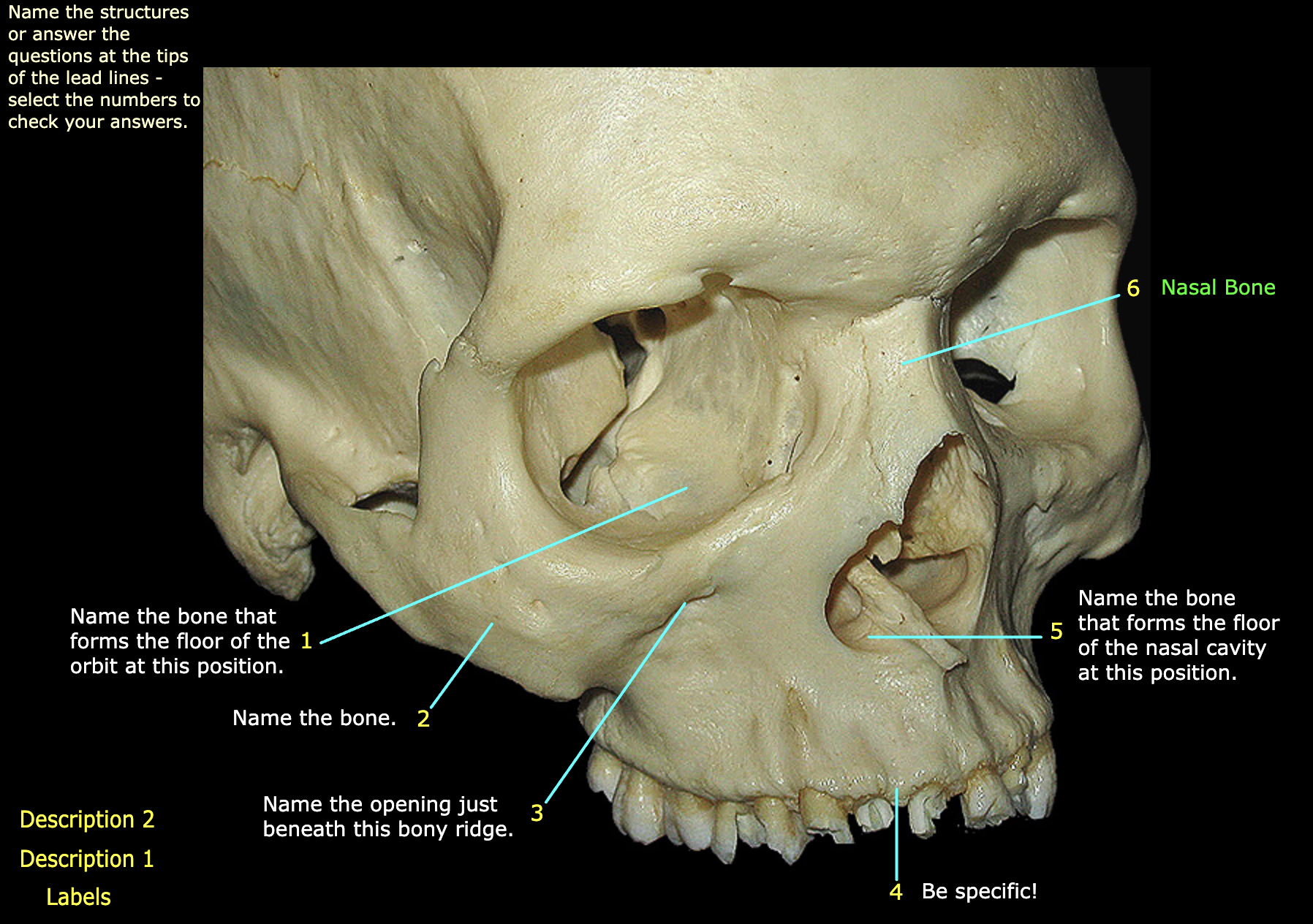 What structure is labeled 3?