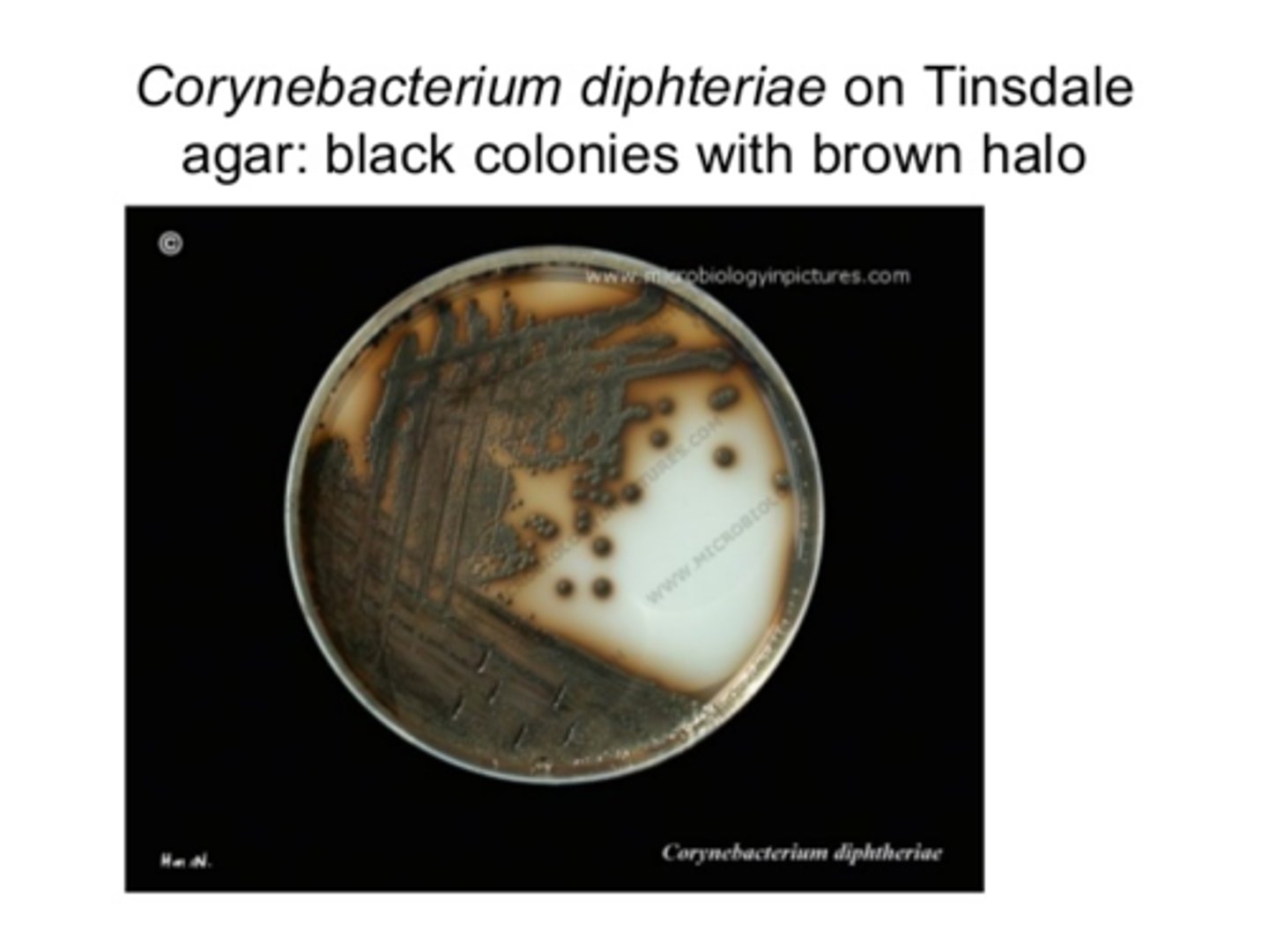 <p>Tindale agar</p>