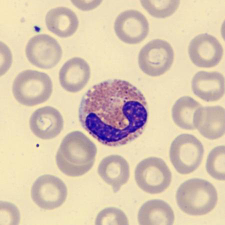 <p>What is this leukocyte?</p>