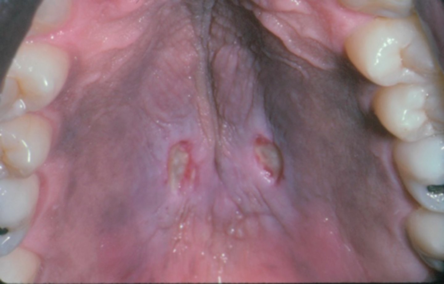 <p>ID the pathology:</p>