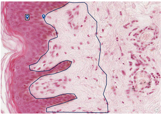 <p>identify area of histological slide, type of CT, and identify structures</p>