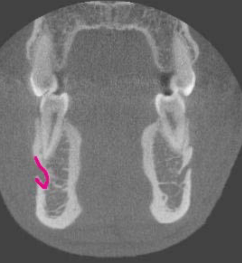 <p>identify the structure </p>