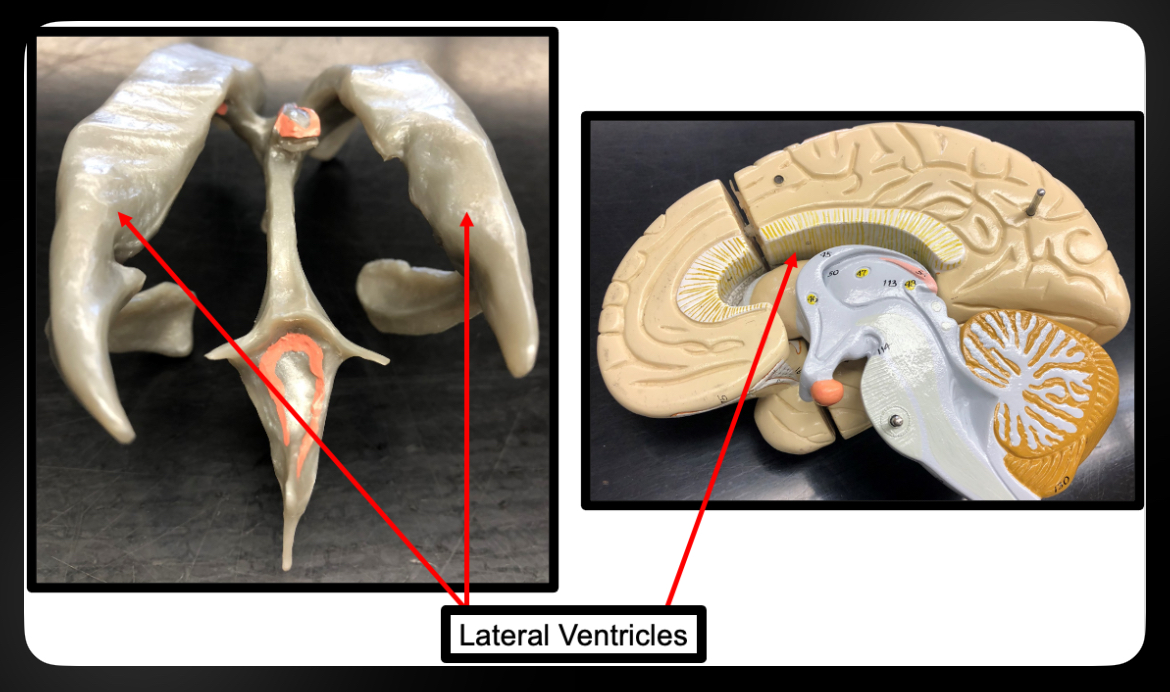 <p>Lateral Ventricles</p>