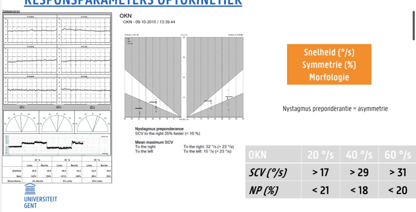 <p><strong>Waarom nystagmus? </strong>→ Ogen kunnen niet onbeperkt draaien → trage fase + snelle fase</p><ul><li><p>Visueel gestuurd of vestibulair → zorgt voor stabiel beeld.</p></li><li><p>Richting van snelle fase = benoemen (beter zichtbaar)</p></li></ul><p><strong>Parameters:</strong></p><ul><li><p><strong>Snelheid (°/s)</strong></p></li><li><p><strong>Symmetrie (%)</strong></p></li><li><p><strong>Morfologie</strong></p></li></ul><p><strong>SCV</strong> = <em>Slow Component Velocity</em> (snelheid trage fase).</p><p><strong>NP</strong> = <em>Nystagmus Preponderantie</em> (asymmetrie).</p><p>Voorbeeld: SCV 35% sneller naar rechts → <strong>nystagmus naar links</strong> (richting = snelle fase!)</p>