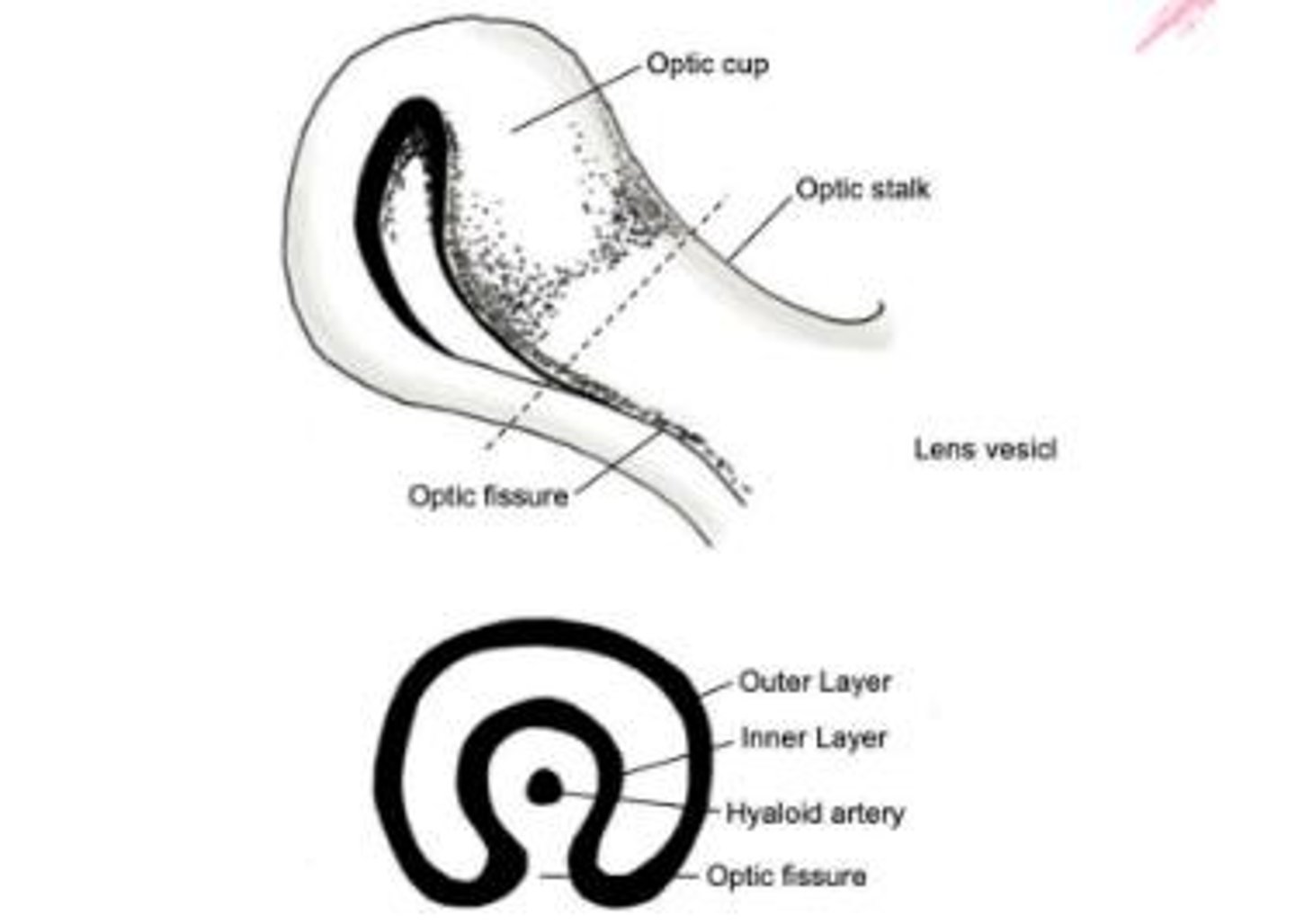 <p>A cleft formed during the development of the optic cup where mesenchyme enters to contribute to the formation of the eye.</p>