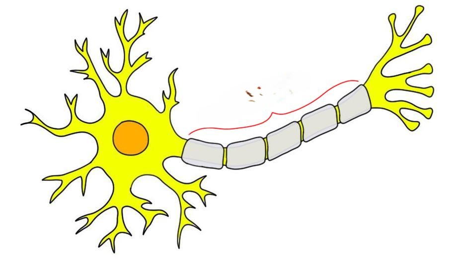<p>the long, slender projection of a neuron that conducts electrical impulses away from the cell body. </p>