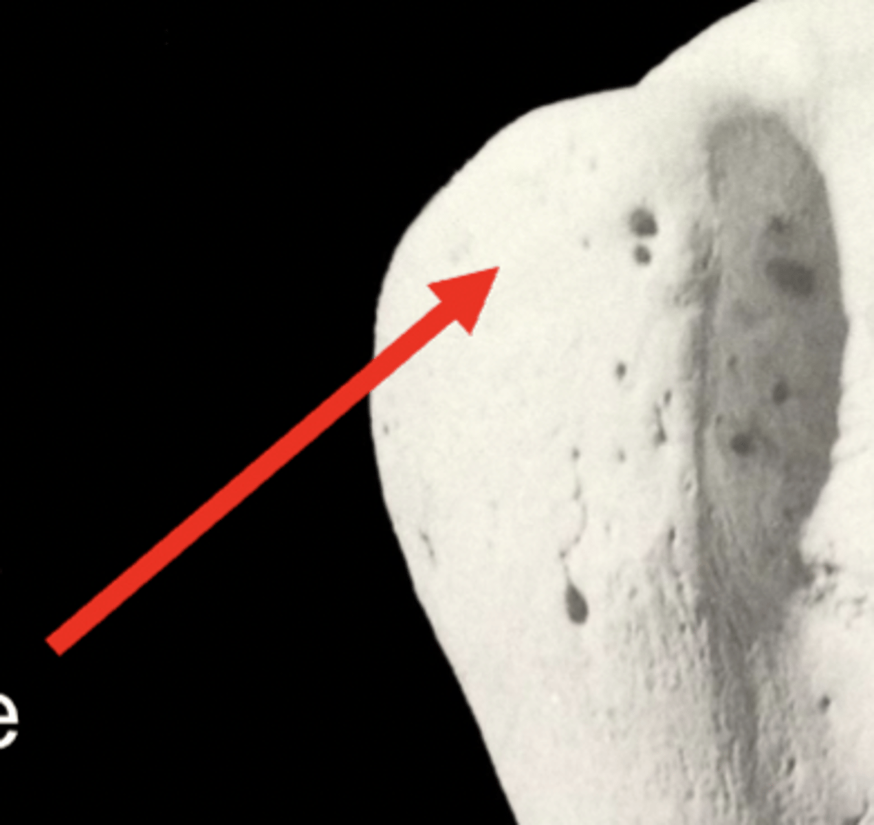 <p>greater tubercle</p>