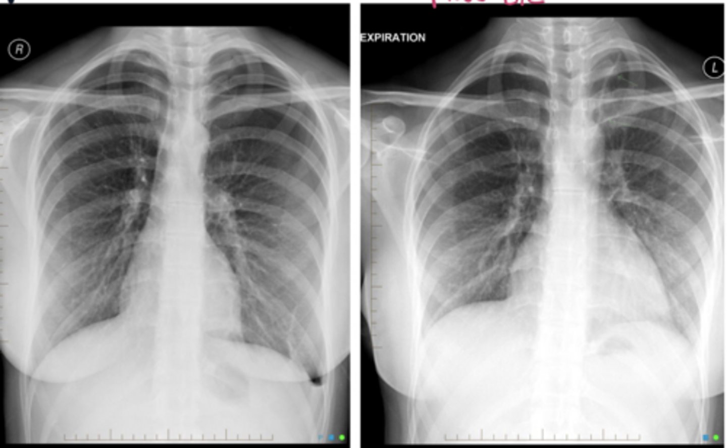 <p>What is the diagnosis?</p>