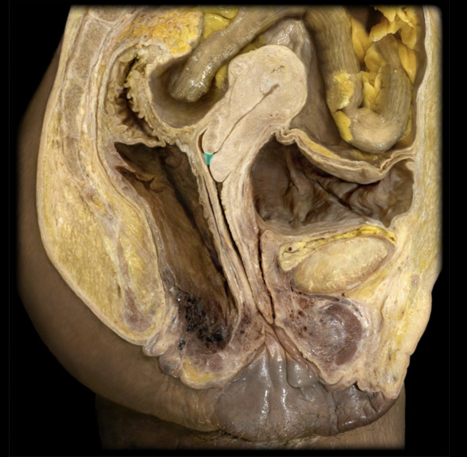 <p>What structure is shown?</p>