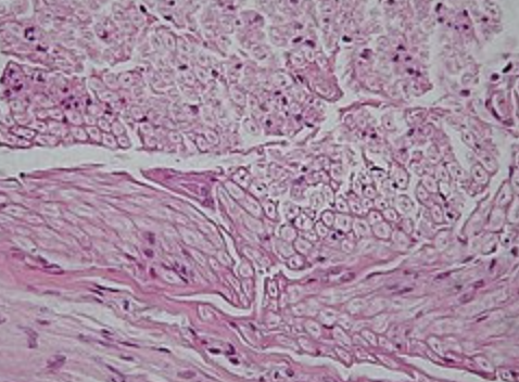 <p>Composed of neurons and glial cells, nervous tissue is responsible for transmitting electrical signals throughout the body, enabling communication between different parts.</p>