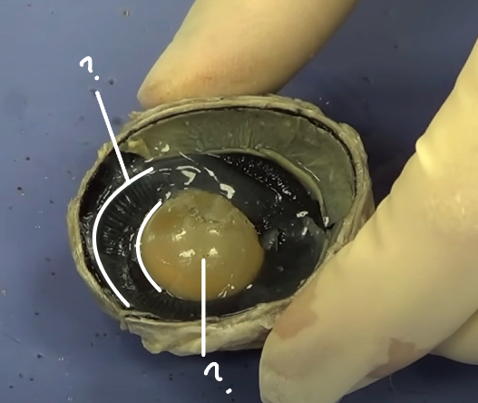 <p>Identify the center clear part</p>