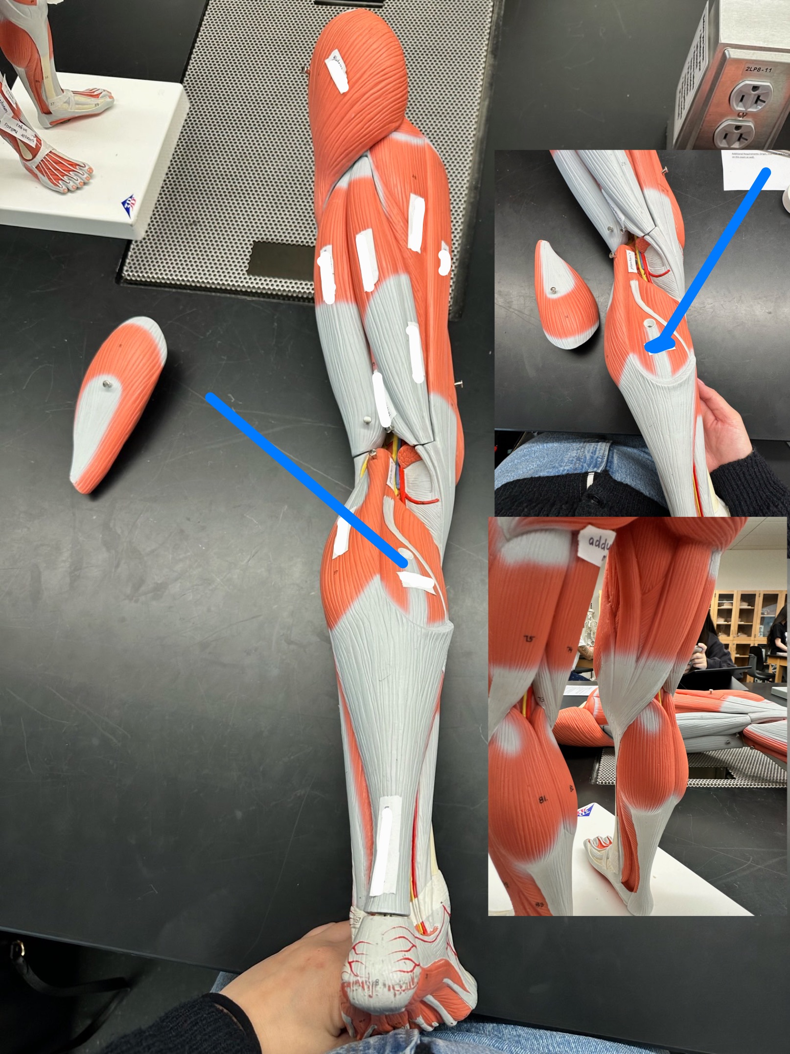 <p>ID muscle</p>