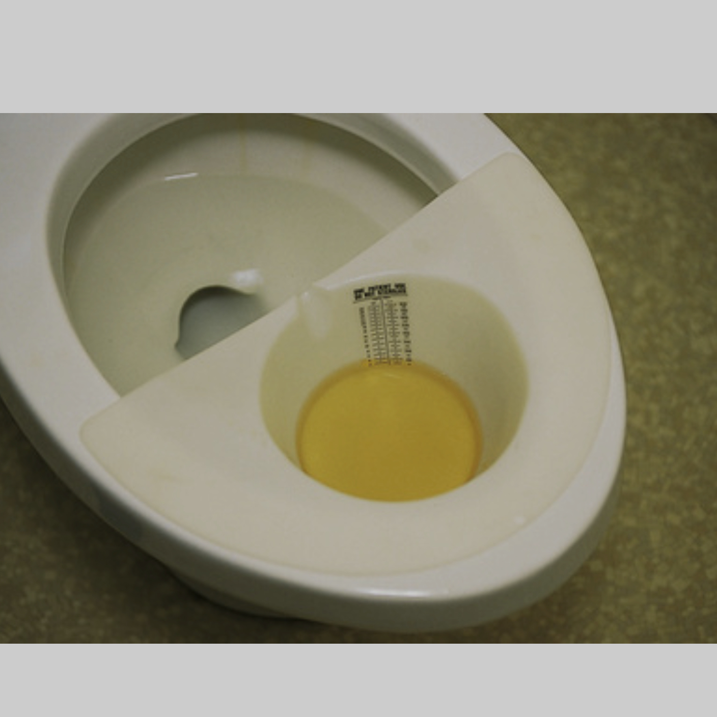 <p>What is this and which urine sample is it used for?</p>