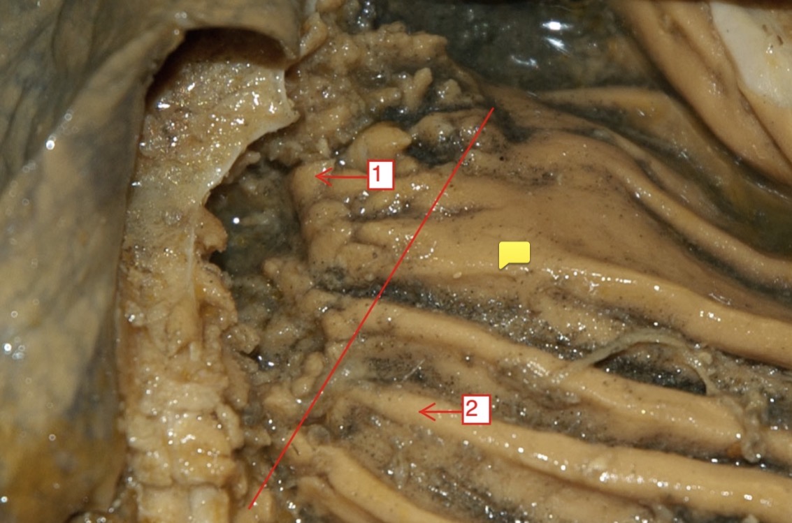 <p>what does the red line show ?</p>